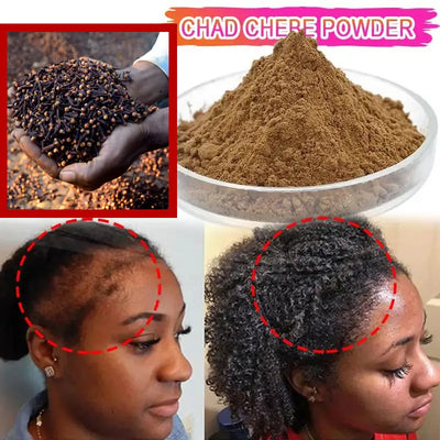 Huile de croissance rapide des cheveux, Traction africaine folle, masque capillaire d'alopécie Chebe, Anti-rottura des cheveux, renforcement des cheveux, Spray de traitement contre la perte de cheveux