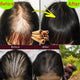 Huile de croissance rapide des cheveux, Traction africaine folle, masque capillaire d'alopécie Chebe, Anti-rottura des cheveux, renforcement des cheveux, Spray de traitement contre la perte de cheveux