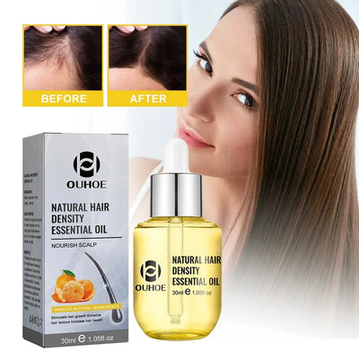 Huile essentielle naturelle pour la croissance des cheveux, Essence de gingembre, traitement des cheveux épais, Anti-perte de cheveux, coffret cadeau pour hommes et femmes